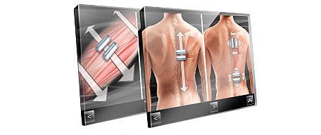 endermologie mmcare